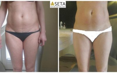 SAI PERCHE’ ABBIAMO LA FISSA DELL’ADDOME?